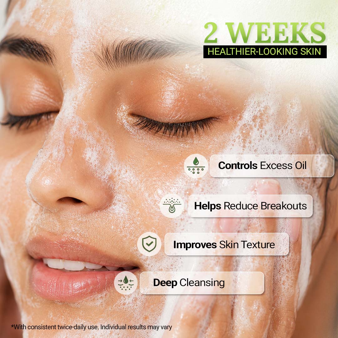 Foaming Face Wash for Oily & Acne-Prone Skin | Mandelic Acid, Tea Tree oil, Aloe vera