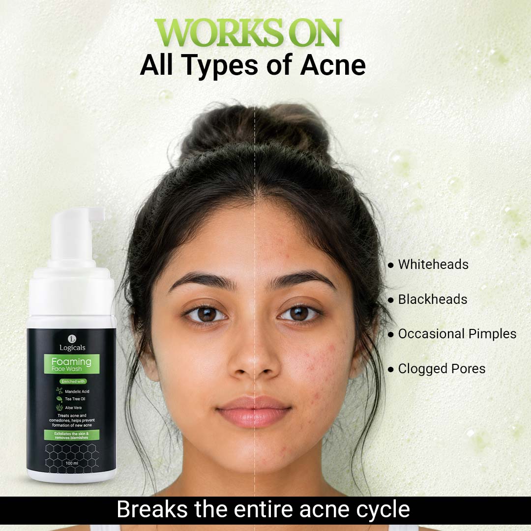 Foaming Face Wash for Oily & Acne-Prone Skin | Mandelic Acid, Tea Tree oil, Aloe vera