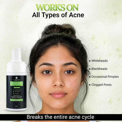 Foaming Face Wash for Oily & Acne-Prone Skin | Mandelic Acid, Tea Tree oil, Aloe vera